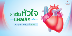 1) Info_ผ่าตัดหัวใจแผลเล็ก เพื่อคุณภาพชีวิตที_0